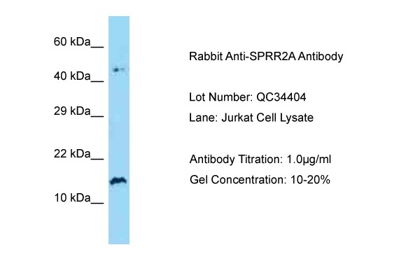Host: Rabbit Target Name: SPRR2A Sample Type: Human Jurkat Antibody Dilution: 1.0ug/ml