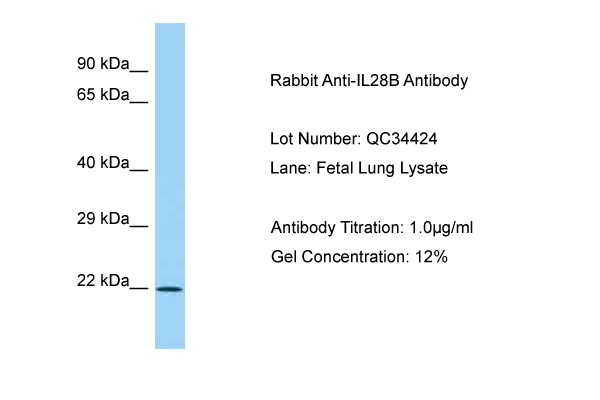 Host: Rabbit Target Name: IL28B Sample Type: Fetal Lung Antibody Dilution: 1.0ug/ml