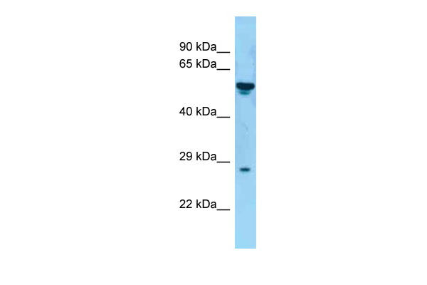 WB Suggested Anti-TNFSF8 Antibody Titration: 1.0 ug/ml Positive Control: Fetal kidney