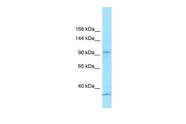 WB Suggested Anti-KCP Antibody Titration: 1.0 ug/ml Positive Control: U937 Whole Cell