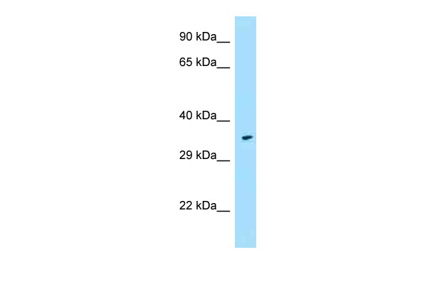 WB Suggested Anti-FPR1 Antibody Titration: 1.0 ug/ml Positive Control: Fetal Heart