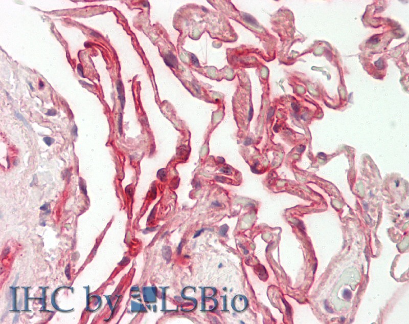 Rabbit Anti-RXFP2 antibody Catalog Number: ARP63832 Formalin Fixed Paraffin Embedded Tissue: Human Lung Primary antibody Concentration: 1:100 Secondary Antibody: Donkey anti-Rabbit-Cy3 Secondary Antibody Concentration: 1:200 Magnification: 20x Exposure Time: 0.5-2.0sec