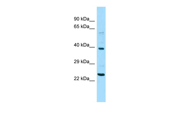 WB Suggested Anti-NPIP Antibody Titration: 1.0 ug/ml Positive Control: Hela Whole Cell