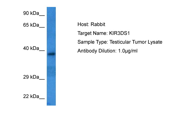 Host: Rabbit Target Name: KIR3DS1 Sample Tissue: Human Testicular Tumor lysates Antibody Dilution: 1ug/ml