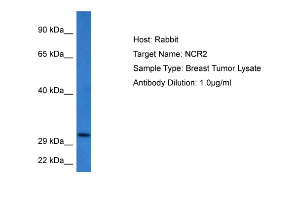 Host: Rabbit Target Name: NCR2 Sample Tissue: Human Breast Tumor lysates Antibody Dilution: 1ug/ml