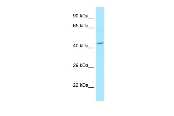 WB Suggested Anti-MPP1 Antibody Titration: 1.0 ug/ml Positive Control: NCI-H226 Whole Cell