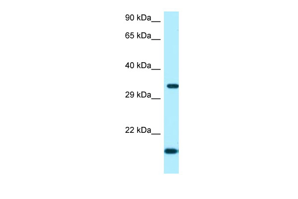 WB Suggested Anti-ORC5 Antibody Titration: 1.0 ug/ml Positive Control: Fetal Heart