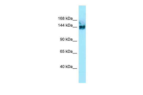 WB Suggested Anti-SYNGAP1 Antibody Titration: 1.0 ug/ml Positive Control: Fetal kidney