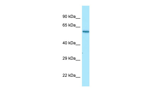 WB Suggested Anti-NMD3 Antibody Titration: 1.0 ug/ml Positive Control: Fetal kidney