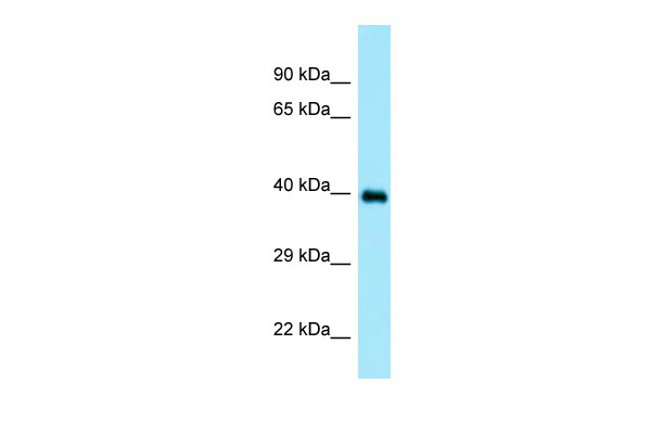 WB Suggested Anti-DOC2A Antibody Titration: 1.0 ug/ml Positive Control: Placenta