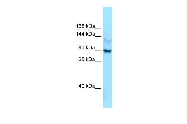 WB Suggested Anti-LRRC7 Antibody Titration: 1.0 ug/ml Positive Control: Jurkat Whole Cell