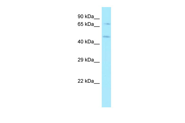WB Suggested Anti-HS6ST1 Antibody Titration: 1.0 ug/ml Positive Control: MCF7 Whole CellHS6ST1 is supported by BioGPS gene expression data to be expressed in MCF7