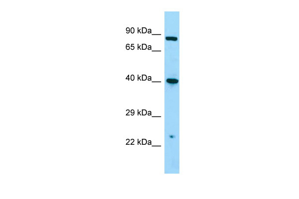 Host: Rabbit Target Name: NMUR1 Antibody Dilution: 1.0ug/ml Sample Type: A549 cell lysateNMUR1 is supported by BioGPS gene expression data to be expressed in A549