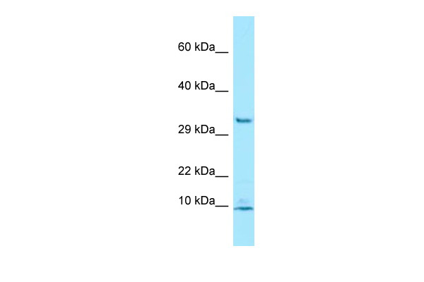 WB Suggested Anti-PDE6G Antibody Titration: 1.0 ug/ml Positive Control: Jurkat Whole Cell