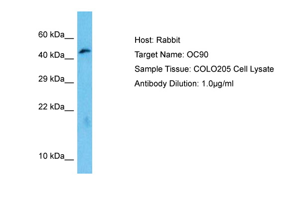 Transfected cell immunoblot: extracts of COS-1 cells transiently transfected with Shank1, Shank2 or Shank3 plasmids and probed with N23B/6 TC supe (left panel) or a monoclonal lane loading control (right panel).