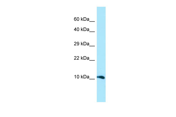 WB Suggested Anti-GGNBP1 Antibody Titration: 1.0 ug/ml Positive Control: Placenta