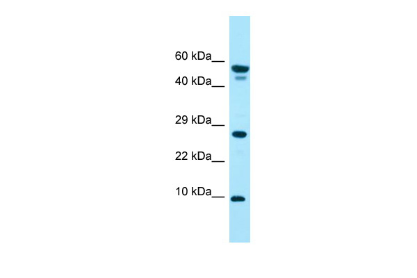 WB Suggested Anti-GGNBP1 Antibody Titration: 1.0 ug/ml Positive Control: Fetal Liver