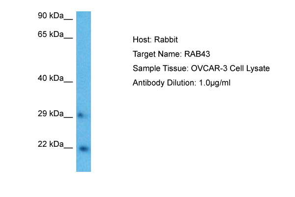 WB Suggested Anti-RAB43 antibody Titration: 1 ug/mL Sample Type: Human OVCAR-3 Whole Cell