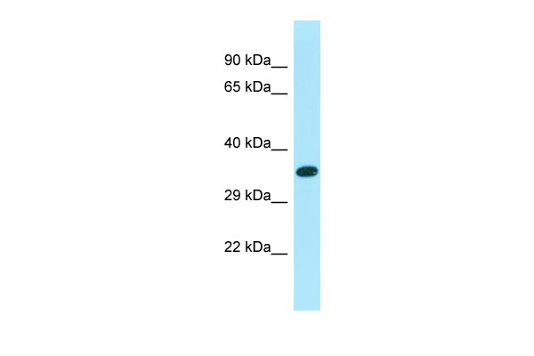 Host: Rabbit Target Name: XKR6 Sample Type: MCF7 Whole cell lysates Antibody Dilution: 1.0ug/ml
