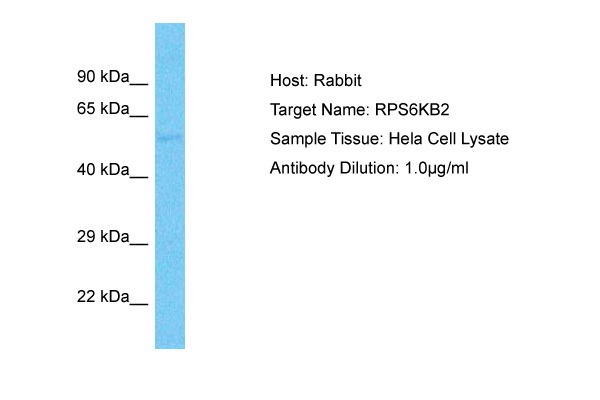 Host: Rabbit Target Name: RPS6KB2 Sample Type: Hela Whole Cell lysates Antibody Dilution: 1.0ug/ml