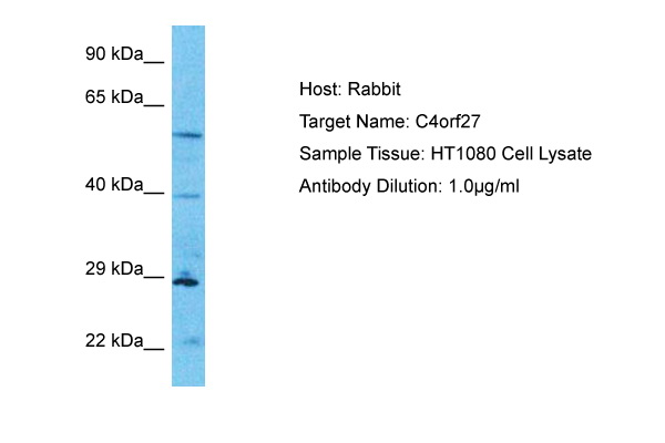 Host: Rabbit Target Name: C4orf27 Sample Type: HT1080 Whole Cell lysates Antibody Dilution: 1.0ug/ml
