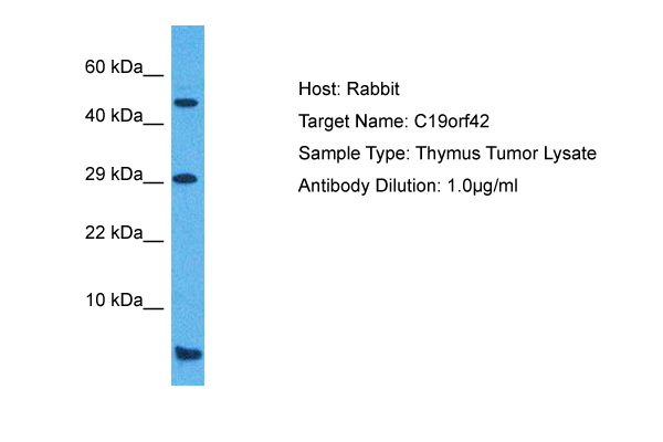 Host: Rabbit Target Name: C19ORF42 Sample Tissue: Human Thymus Tumor lysates Antibody Dilution: 1ug/ml