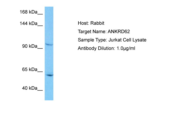 Host: Rabbit Target Name: ANKRD62 Sample Tissue: Human Jurkat Whole Cell lysates Antibody Dilution: 3ug/ml