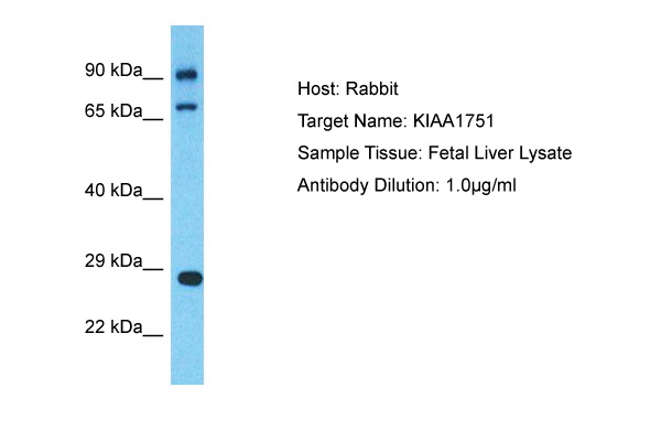 Host: Rabbit Target Name: KIAA1751 Sample Tissue: Human Fetal Liver Antibody Dilution: 1ug/ml