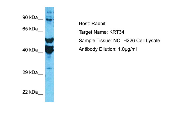 Host: Rabbit Target Name: KRT34 Sample Type: NCI-H226 Whole Cell lysates Antibody Dilution: 1.0ug/ml