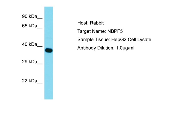 Host: Rabbit Target Name: NBPF5 Sample Type: HepG2 Whole Cell lysates Antibody Dilution: 1.0ug/ml