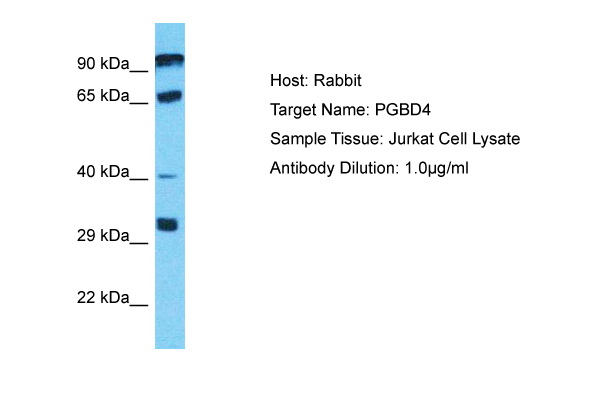 Host: Rabbit Target Name: PGBD4 Sample Type: Jurkat Whole Cell lysates Antibody Dilution: 1.0ug/ml
