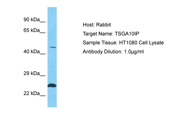 Host: Rabbit Target Name: TSGA10IP Sample Type: HT1080 Whole Cell lysates Antibody Dilution: 1.0ug/ml