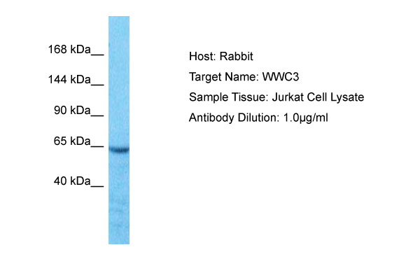 Host: Rabbit Target Name: WWC3 Sample Type: Jurkat Whole Cell lysates Antibody Dilution: 1.0ug/ml