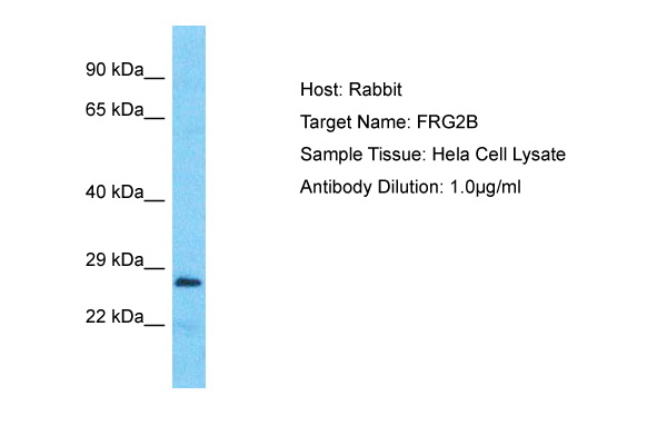 Host: Rabbit Target Name: FRG2B Sample Type: Hela Whole Cell lysates Antibody Dilution: 1.0ug/ml