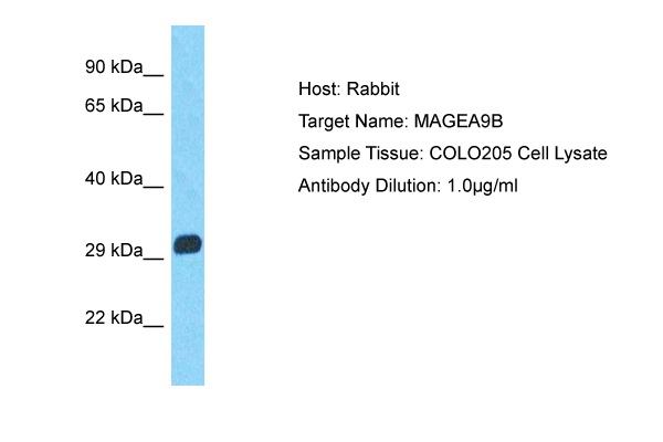 Antibody sensitivity Whole cell lysates of vanadate-treated HepG2 containing defined cell numbers per lane were applied to SDS-PAGE and transferred to PVDF membranes. Immunoblots were probed with mab AM00040PU-N (0.5 ug/ ml) for 1 h at RT and developed by ECL (exp. time: 30 sec). lane 1: 160.000 cells, lane 2: 80.000 cells lane 3: 40.000 cells, lane 4: 20.000 cells, lane 5: 10.000 cells, lane 6: 5.000 cells, lane 7: 2.500 cells, lane 8: 1.000 cells