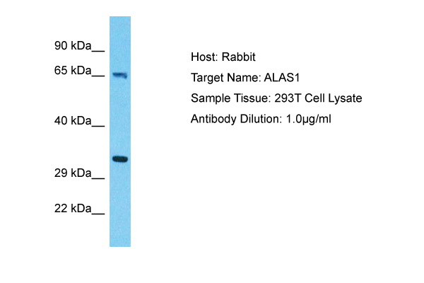 ERBB2 Transactivation: Serum starved A431 cells were treated for 15 min as indicated. Whole cell lysates were separated by SDS-PAGE (ca 20.000 cells/lane). The immunoblot was probed with mab erbB2-7F8 (0.5 ug/ ml) for 1h at RT and developed by ECL (exp. time: 30 sec). Lane 1: Control Lane 2: PMA Lane 3: LPA Lane 4: Ceramide Lane 5: Bradykinin Lane 6: Bombesin