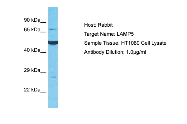 Detection of endogenous MAPK7 / erk5 Whole cell lysates of serum starved tumor cells (20.000 cells per lane) were applied to SDS-PAGE and transferred to a PVDF membrane. Immunoblots were probed with mab MAPK7-12F2 (0.5 ug/ ml) for 1h at RT and developed by ECL (exp. time: 30 sec). Lane 1: A431 Lane 2: A549 Lane 3: SKOV3 Lane 4: OVCAR5 Lane 5: HaCaT Lane 6: PC3 Lane 7: HeLa Lane 8: HepG2