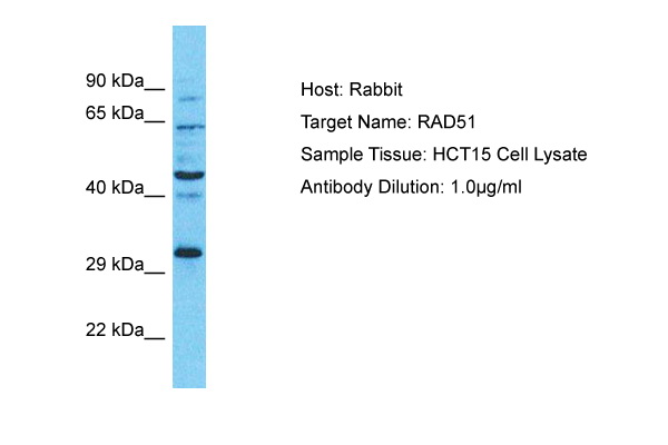 fos activation Serum starved HepG2 cells were incubated with 10 ng/ml EGF for the indicated times. Whole cell lysates were prepared with lysis buffer V19 and separated by SDS-PAGE (ca 20.000 cells/lane). Immunoblots were probed with mab fos-34E4 (0.5 ug/ ml) for 1h at room temperature and developed by ECL (exp. time: 30 sec). lane 1: control; lane 2: 5 min EGF; lane 3: 15 min EGF; lane 4: 30 min EGF; lane 5: 1h EGF;lane 6; 2h EGF lane 7: 4h EGF; lane 8: 8h EGF