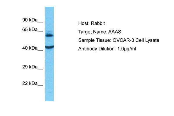 Host: Rabbit Target Name: AAAS Sample Type: OVCAR-3 Whole Cell lysates Antibody Dilution: 1.0ug/ml