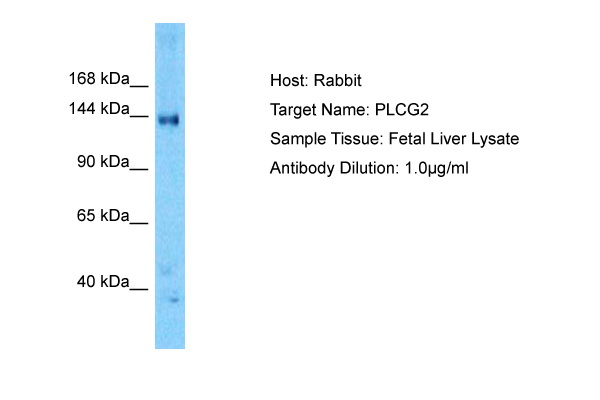 Detection of endogenous MKK7: Whole cell lysates of serum starved tumor cells (20.000 cells per lane) were applied to SDS-PAGE and transferred to a PVDF membrane. The immunoblot was probed with mab MKK7-10F7 (0.5 ug/ ml) for 1h at RT and developed by ECL (exp. time: 30 sec). lane 1: A431; lane 2: A549; lane 3: SKOV3; lane 4: OVCAR5; lane 5: HaCaT; lane 6: PC3; lane 7: HeLa; lane 8: HepG2