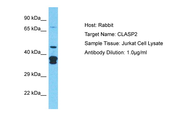 Detection of endogenous Mxi / SAPK2alpha Whole cell lysates of serum starved tumor cells (20.000 cells per lane) were applied to SDS-PAGE and transferred to a PVDF membrane. The immunoblot was probed with mab Mxi-2F2 (0.5 ug/ ml) for 1h at RT and developed by ECL (exp. time: 30 sec). Mab Mxi-2F2 recognizes SAPK2a/p38 at 38 kDa and its splice variant Mxi2 at 30 kDa. lane 1: A431; lane 2:SW480; lane 3: SW620; lane 4: HT29; lane 5: MCF7; lane 6: MDA231; lane 7: T47D