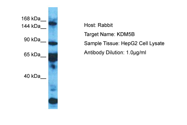 Host: Rabbit Target Name: KDM5B Sample Type: HepG2 Whole Cell lysates Antibody Dilution: 1.0ug/ml