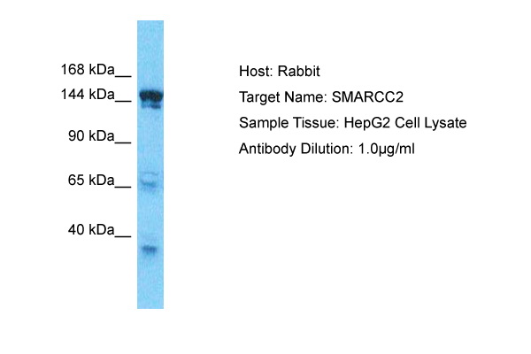 Host: Rabbit Target Name: SMARCC2 Sample Type: HepG2 Whole Cell lysates Antibody Dilution: 1.0ug/ml