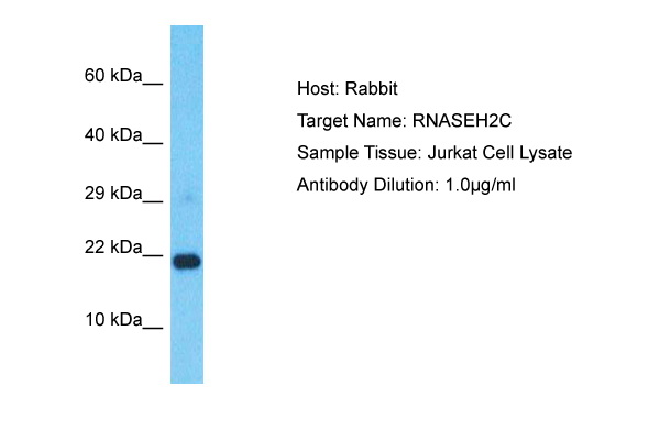 Detection of endogenous p66shc: Whole cell lysates of serum starved tumor cells (ca. 20.000 cells per lane) were applied to SDS-PAGE and transferred to a PVDF membrane. The immunoblot was probed with mab shc/p66-24E4 (0.5 ug/ ml) for 1h at RT and developed by ECL (exp. time: 30 sec). Lane 1: HeLa Lane 2: HepG2 Lane 3: HEK293 Lane 4: SH-SY5Y Lane 5: MDCK Lane 6: PC12 Lane 7: CMT 93 Lane 8: Neuro 2A Lane 9: 3T3