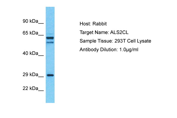 Phosphospecificity Whole cell extracts of control (1), EGF stim ulated (2) or pervanadate treated (3) A549 tumor cells were applied to SDS-PAGE (ca 20.000 cells per lane) and transferred to a PVDF membrane. The immunoblot was probed with mab STAT1-12C5 (0.5