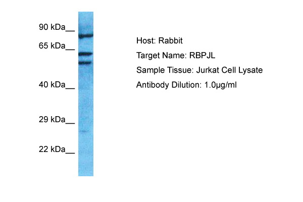 Phosphospecificity Whole cell lysates of untreated (Lane 1) and IL4-treated (Lane 2) HepG2 cells were applied to SDS-PAGE and transferred to a PVDF membrane. The immunoblot was probed with STAT6 antibody clone 16E12 at 1 ug/ml for 1h at 15-22°C and developed by ECL (exposure time: 3min).