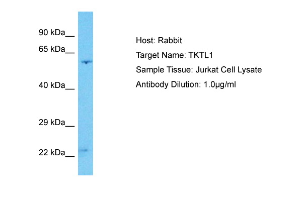 Host: Rabbit Target Name: TKTL1 Sample Type: Jurkat Whole Cell lysates Antibody Dilution: 1.0ug/ml