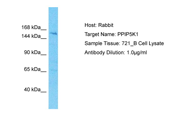 Host: Rabbit Target Name: PPIP5K1 Sample Type: 721_B Whole Cell lysates Antibody Dilution: 1.0ug/ml