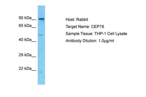 Host: Rabbit Target Name: CEP78 Sample Type: THP-1 Whole Cell lysates Antibody Dilution: 1.0ug/ml