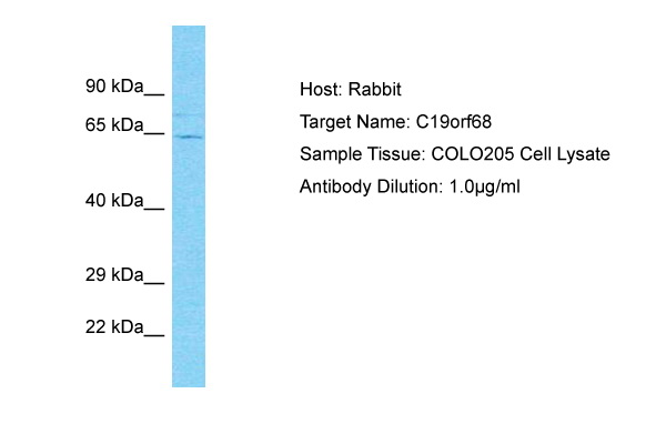 Host: Rabbit Target Name: C19orf68 Sample Type: COLO205 Whole Cell lysates Antibody Dilution: 1.0ug/ml